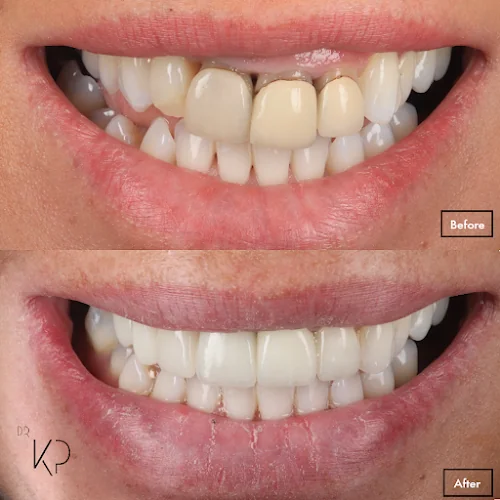 Dr Kalpesh Prajapat - Dental clinic in Stone