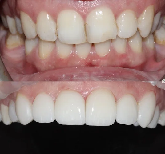 Elegant Smiles Dental and Implant Centre | Award Winning Dentistry - Cosmetic dentist in Spalding