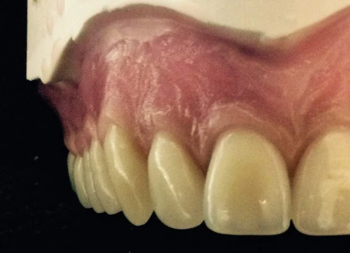 Swindon Dental Laboratory Ltd......Also Providing Denture Repairs to the Public - Dental laboratory in Swindon