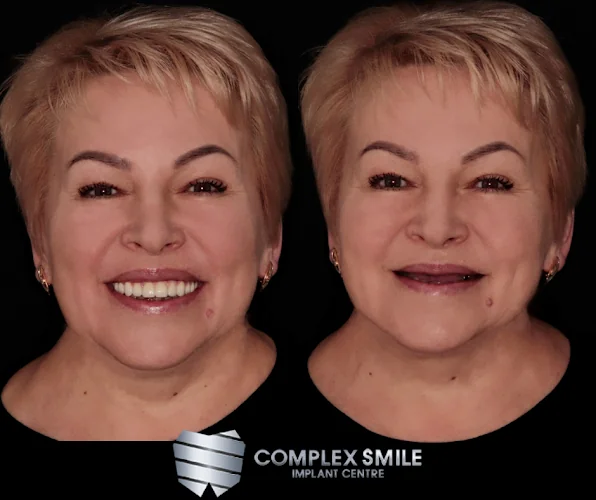 Complex Smile implant centre - Dental clinic in London