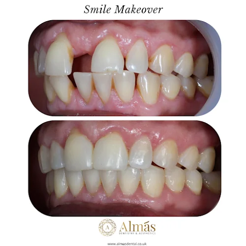 Almás Dentist & Aesthetics - Acton - Cosmetic dentist in London