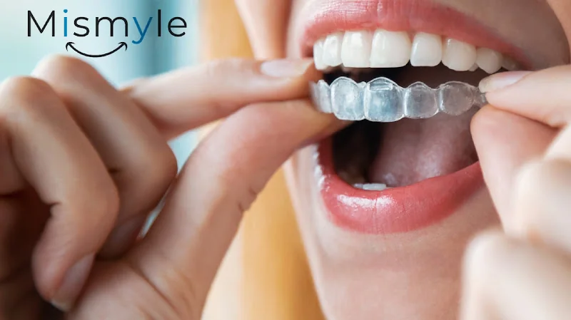 MiSmyle Clear Aligner - Orthodontist in London