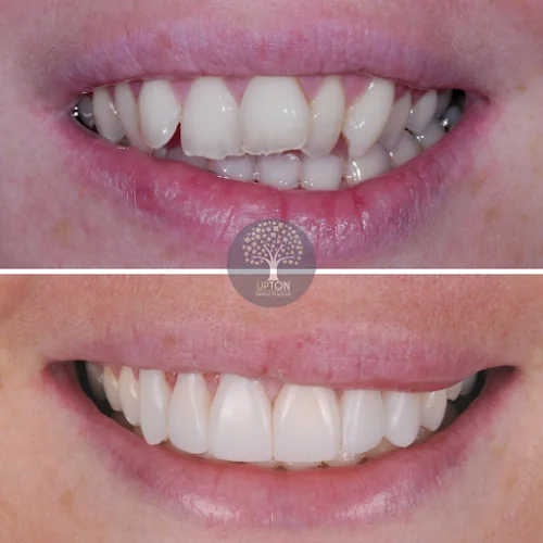 Upton Dental Practice - Dental clinic in Wirral