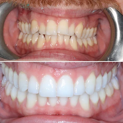 ConfiDental Clinic Surbiton - Dentist in Surbiton