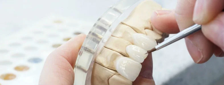 BM Dental Laboratory - Prosthodontist in Glasgow