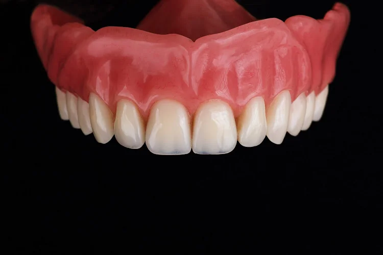 Denture repairs. Weston Dental Laboratory. - Dental laboratory in Weston-super-Mare