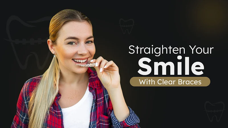 Clear Braces London - Dental clinic in London