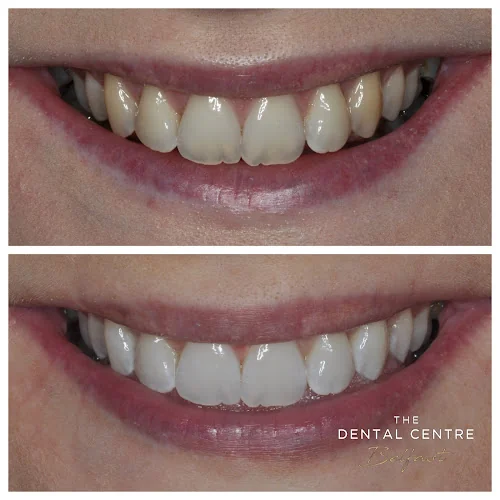 The Dental Centre Belfast - Cosmetic dentist in Belfast