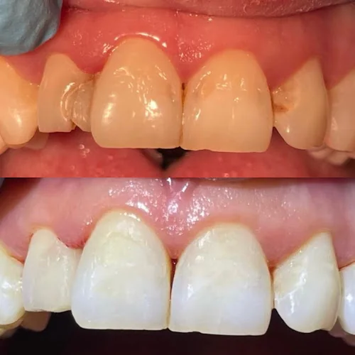 Alauna Dental Care Maryport - Dentist in Maryport