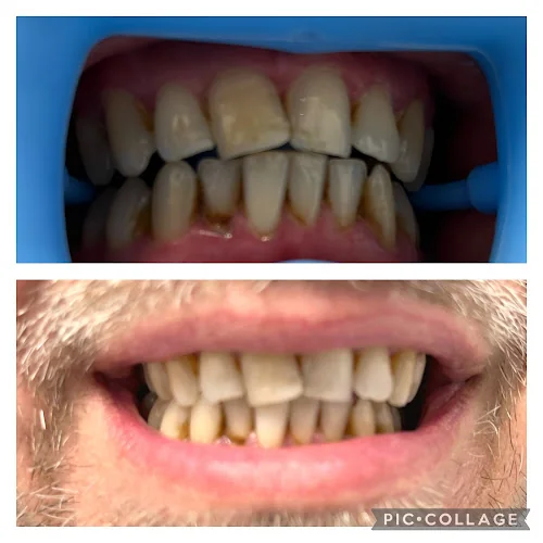 MR WHITE LTD Teeth Whitening Bournemouth - Teeth whitening service in Bournemouth