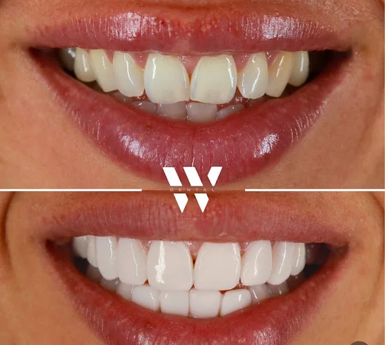 W Dental - Twickenham - Dentist in Twickenham