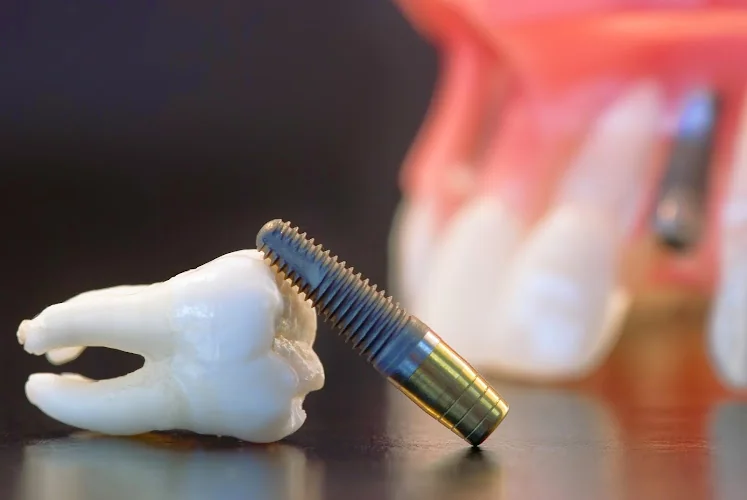 Lovesmile - Dental clinic in Liverpool