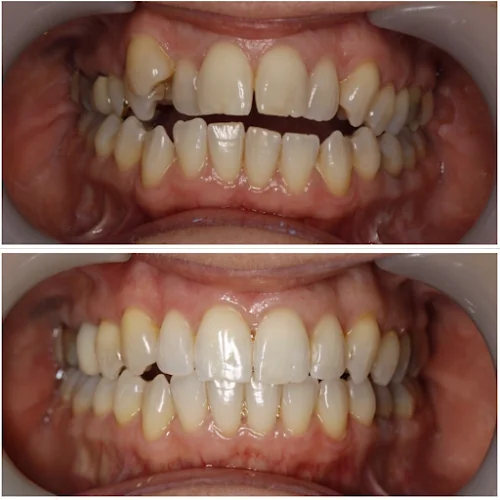 The Smile Clinic Cosmetic Dentistry & Implant Centre - Cosmetic dentist in Colchester