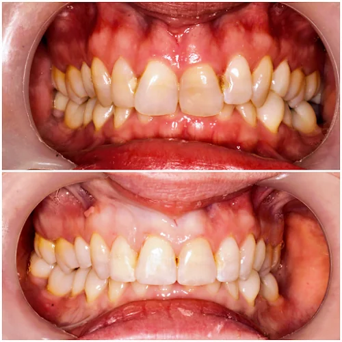 Bethcar Dental Practice - Dental clinic in Ebbw Vale