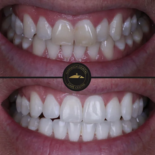 Horwich Dental Care Centre - Dental clinic in Bolton