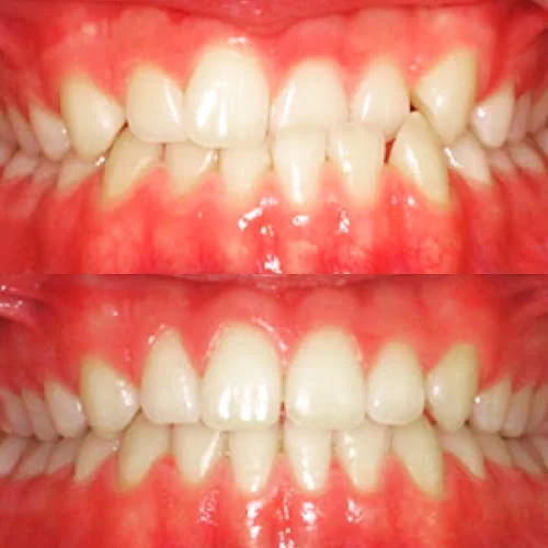 Capital Dental - Dentist in Hampton