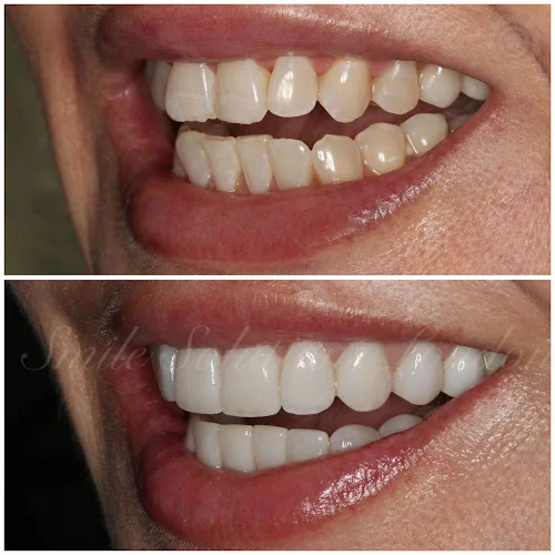 Smile Solutions - Dental clinic in London