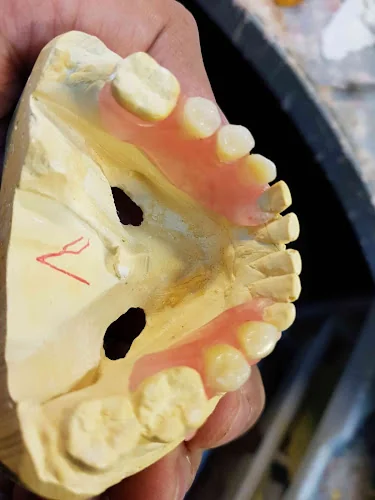 Aymans Denture Repairs & Dental Services - Denture Care Centre in Birmingham