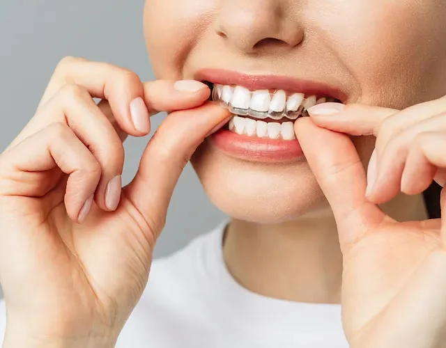 Southend Road Dental Surgery - Essex family dental care - Dental clinic in Rainham