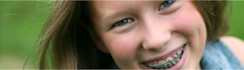 Mid-Wessex Orthodontics - Orthodontist in Salisbury