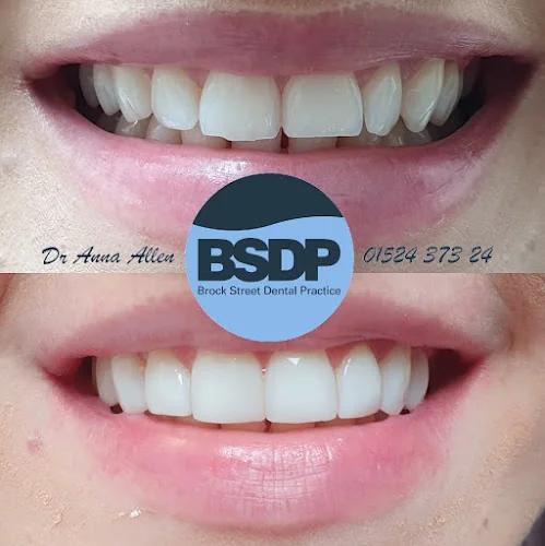 Brock Street Dental Practice - Dental clinic in Lancaster