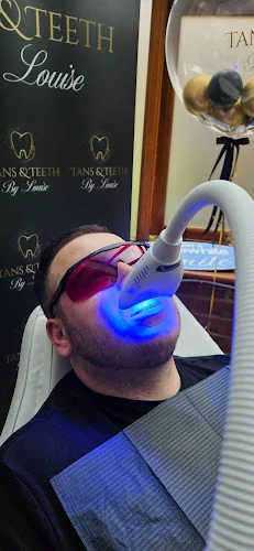 Tans, Teeth & EverythINK - Teeth whitening service in Stevenage