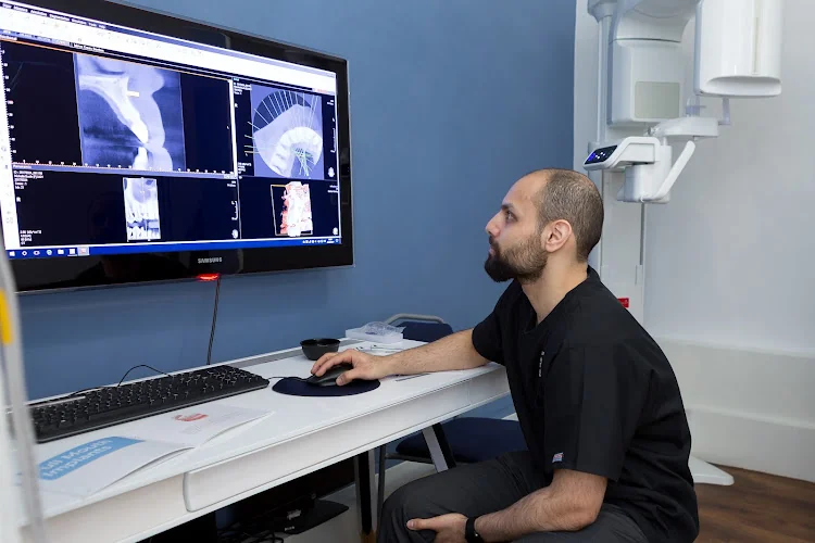 Full Implant Teeth - Dental implants provider in Preston