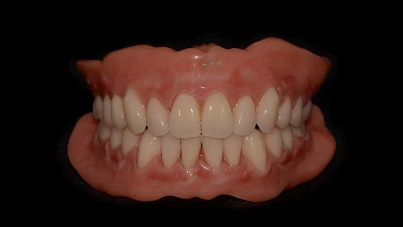 By-Design Dentures - Dentist in Cheltenham