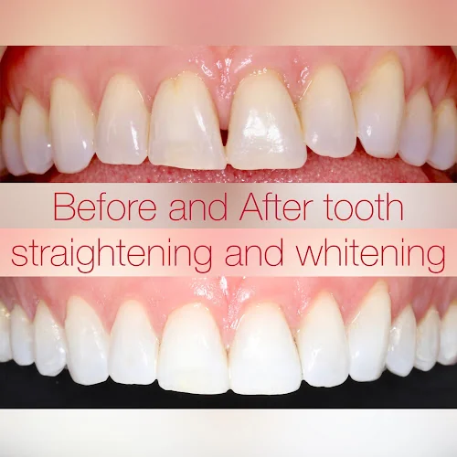 The Dentists Old Market - Dentist in Bristol