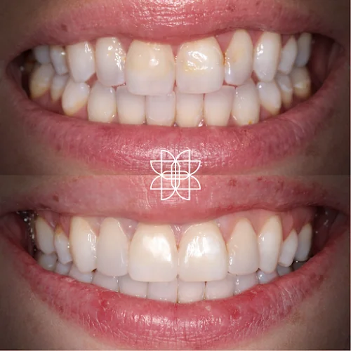 Walton Road Dental Practice - Dental clinic in Warrington