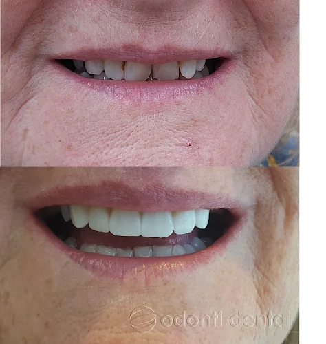 Odonti Dental - Dentist in Eastbourne