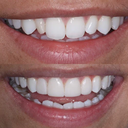 Transform Dental (formerly known as Knutsford Road Dental Clinic) - Cosmetic dentist in Wilmslow