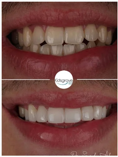 Kidsgrove Dental & Implant Centre | Dentist Stoke-on-Trent - Dentist in Stoke-on-Trent