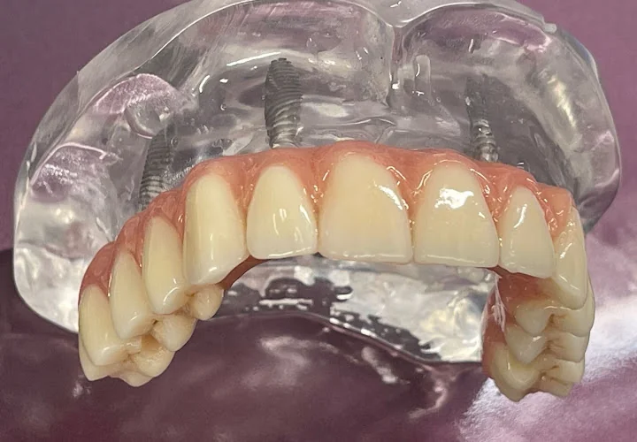 GM Dental Lab - Dental laboratory in Rochester