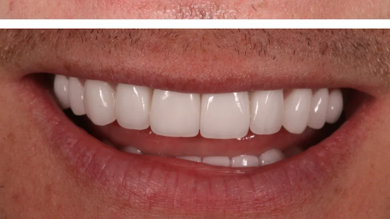 Liam McGrath - Cosmetic dentist in Wirral