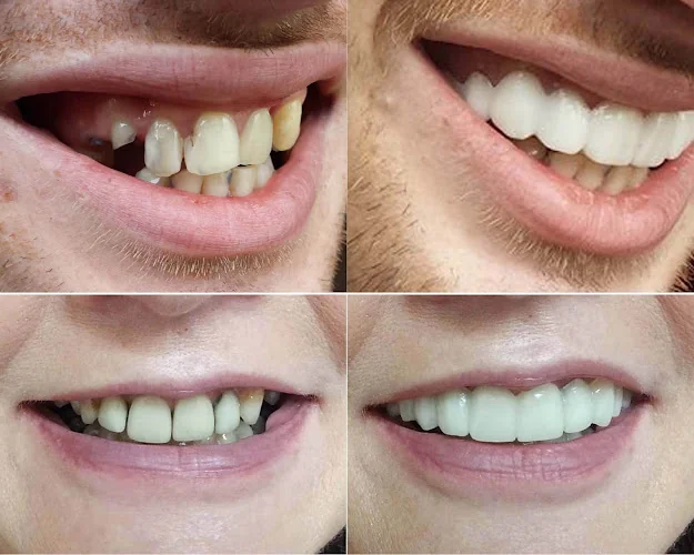 Denture Cosmetics + Instant White Smile - Dental clinic in Liverpool