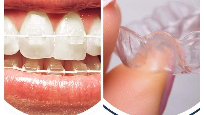 Dr S Dzhoglev - Ortho-Dentist - Dentist in Bury Saint Edmunds