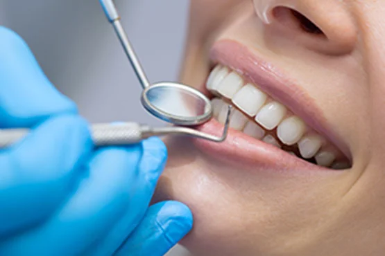 Abbeywood Dental - Dentist in London