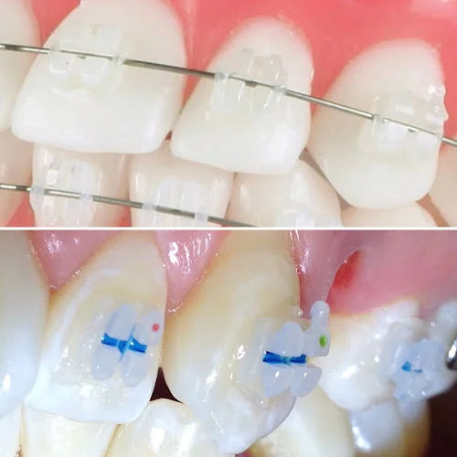 Denise Taylor Orthodontics - Orthodontist in Stockbridge