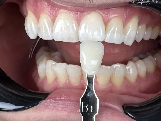 Dr Tim Meskhi - Cosmetic dentist in London