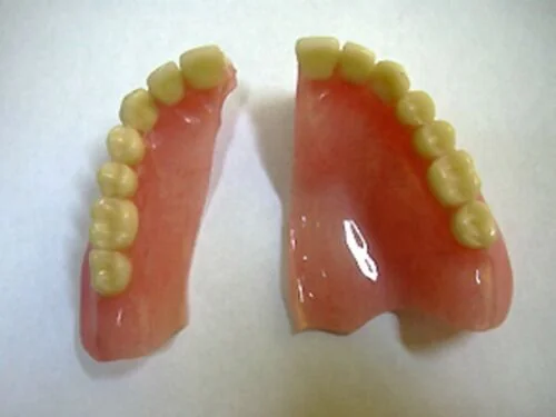 Denture Fix emergency denture repair service - Dental laboratory in Bournemouth