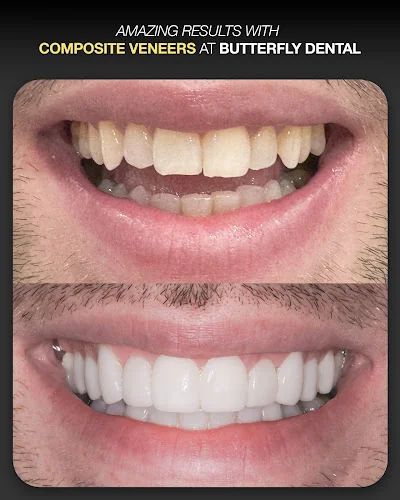 Butterfly Dental Care - Dental clinic in Altrincham