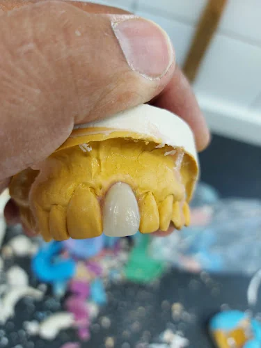 Chewydent Dental Laboratory - Dental laboratory in Waltham Cross