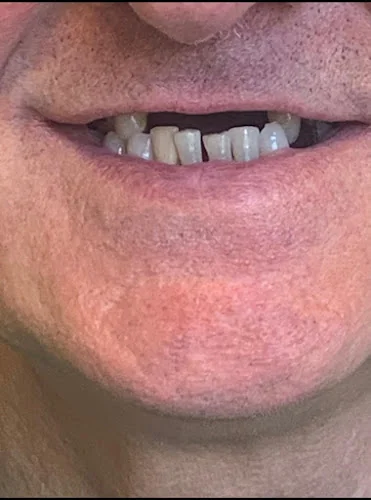 Confident Denture Clinic - Dental clinic in Halifax