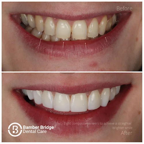 Bamber Bridge Dental Care - Dental clinic in Preston