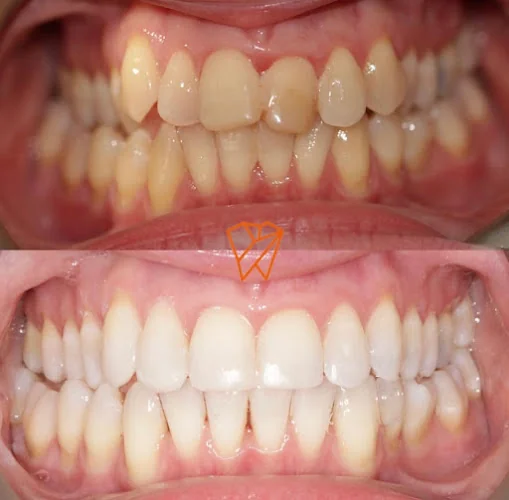 Clayhall Dental Care - Cosmetic & Implant Dentistry - Dental clinic in Ilford