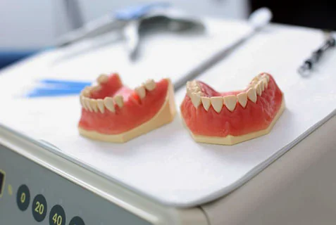Mobile Denture Repair - Denture Care Centre in UK