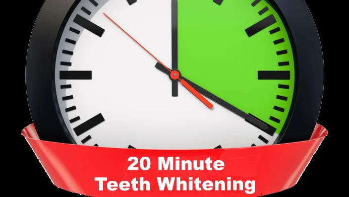 20 Minute Teeth Whitening - Dental clinic in UK