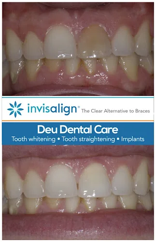 Deu Dental Care - Dental clinic in Leeds