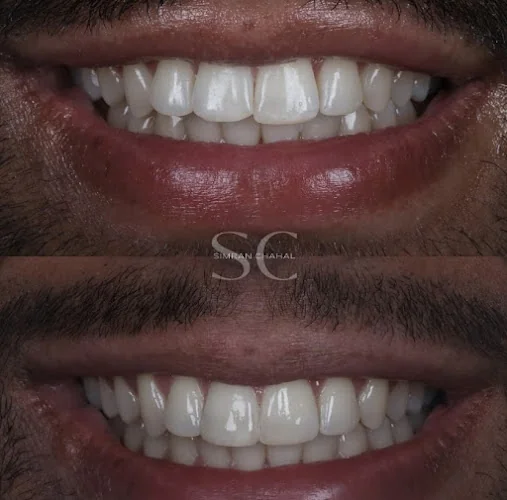 Battersea Dentist - Dentist in London